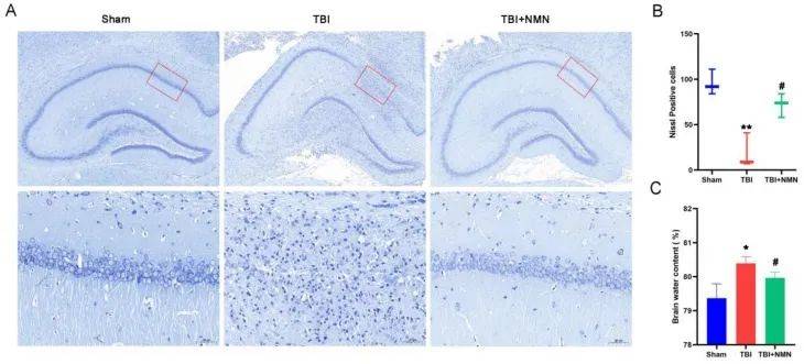 NMN treatment attenuates neural damage in hippocampal CA1 region after TBI