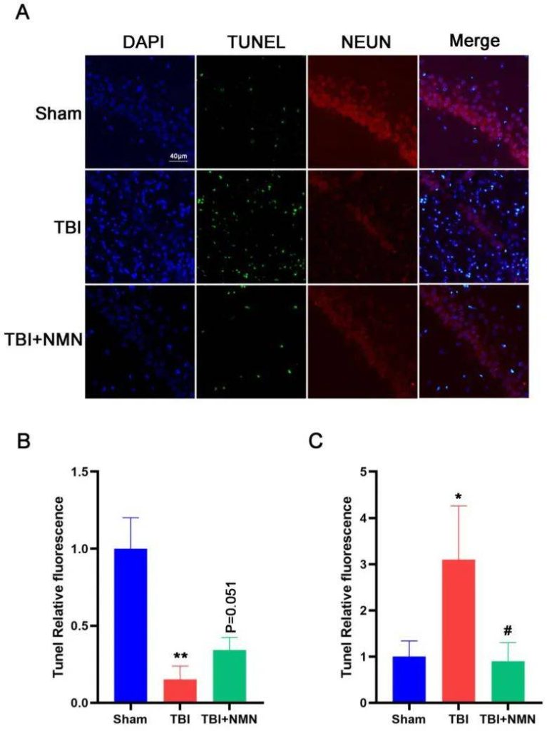 NMN reduces neuronal apoptosis 8 days after TBI